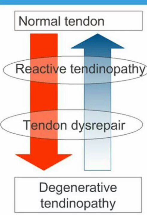 Tendon